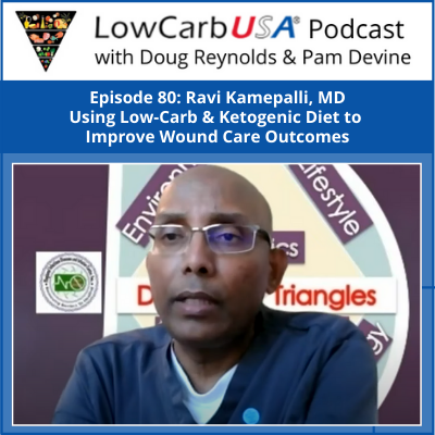 Episode-80-Ravi-Kamepalli-MD-SQUARE-1